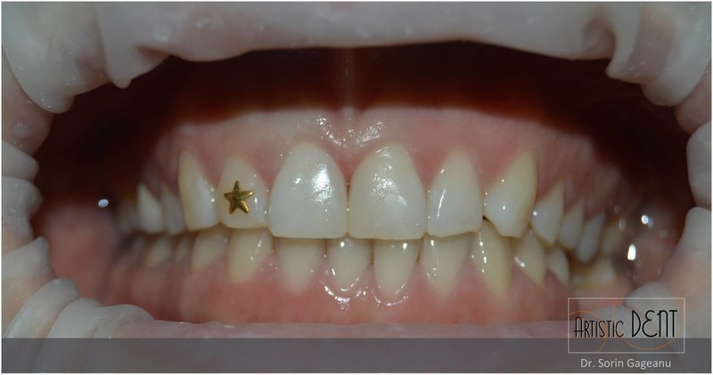 Artistic Dent - Clinica stomatologica, Bucuresti